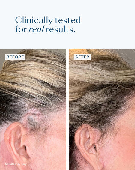 Densifying Scalp Serum